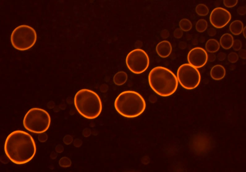 Phosphatidylcholine liposomes stained with acridine orange dye under fluorescence microscopy