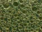 Phosphatidylcholine liposomes in suspension viewed under phase-contrast microscopy