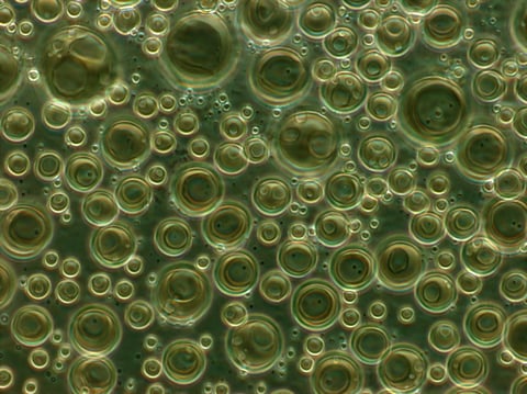 Phosphatidylcholine liposomes in suspension viewed under phase-contrast microscopy