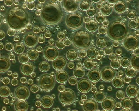 Phosphatidylcholine liposomes in suspension viewed under phase-contrast microscopy