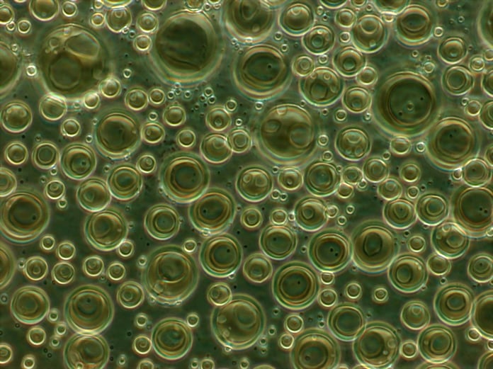 Phosphatidylcholine liposomes in suspension viewed under phase-contrast microscopy