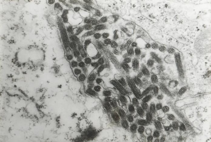 Transmission electron microscopic image confirming Marburg virus in a hemorrhagic fever patient