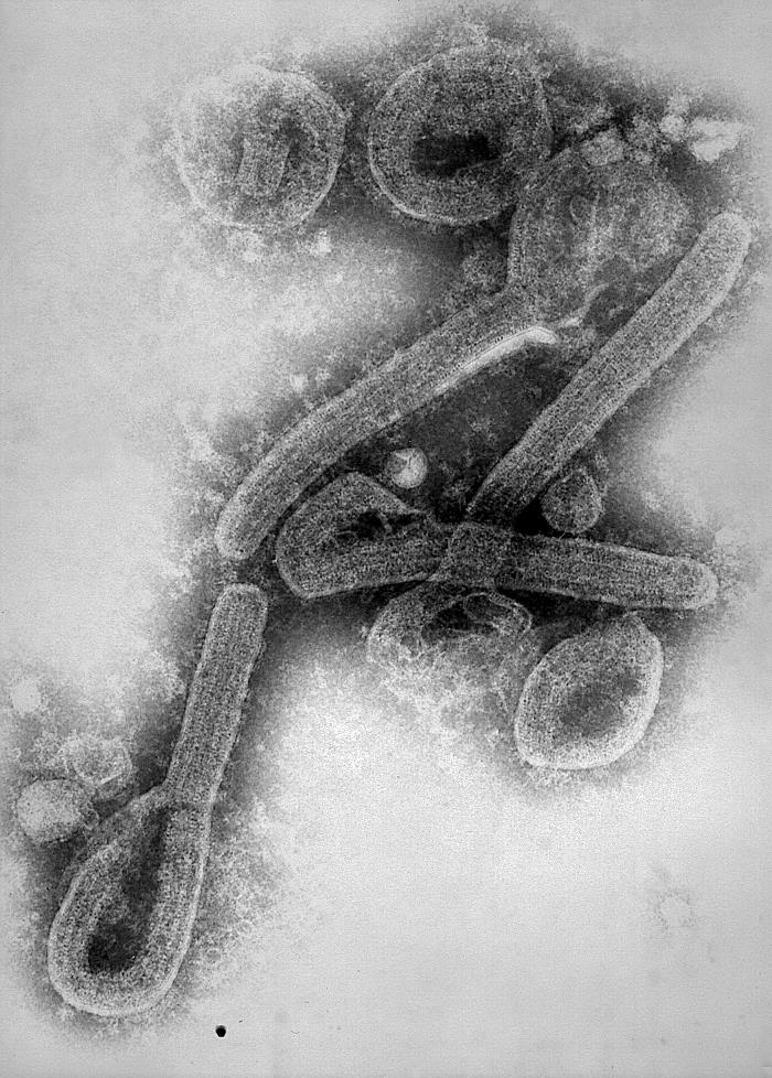 Transmission electron microscopic image revealing the ultrastructural morphology of Marburg virus virions