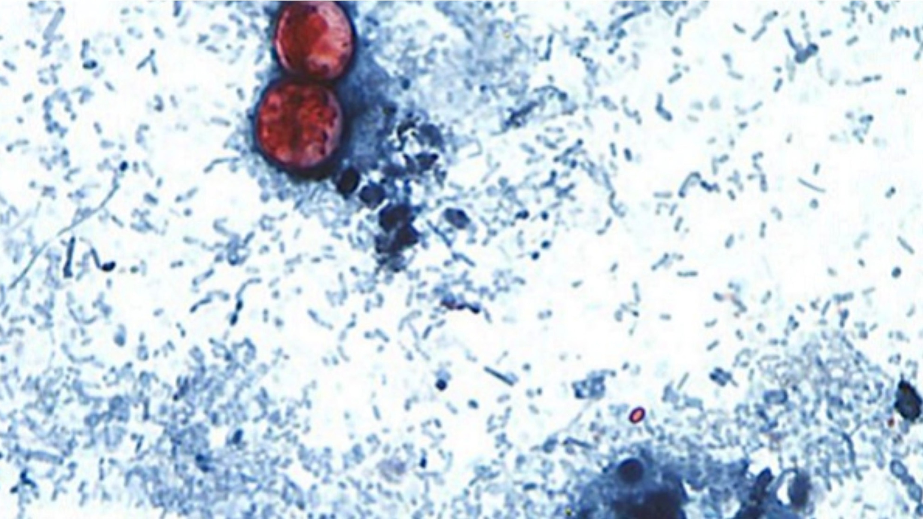 Cyclospora cayetanensis under microscope CDC image Michigan outbreak investigation 2026