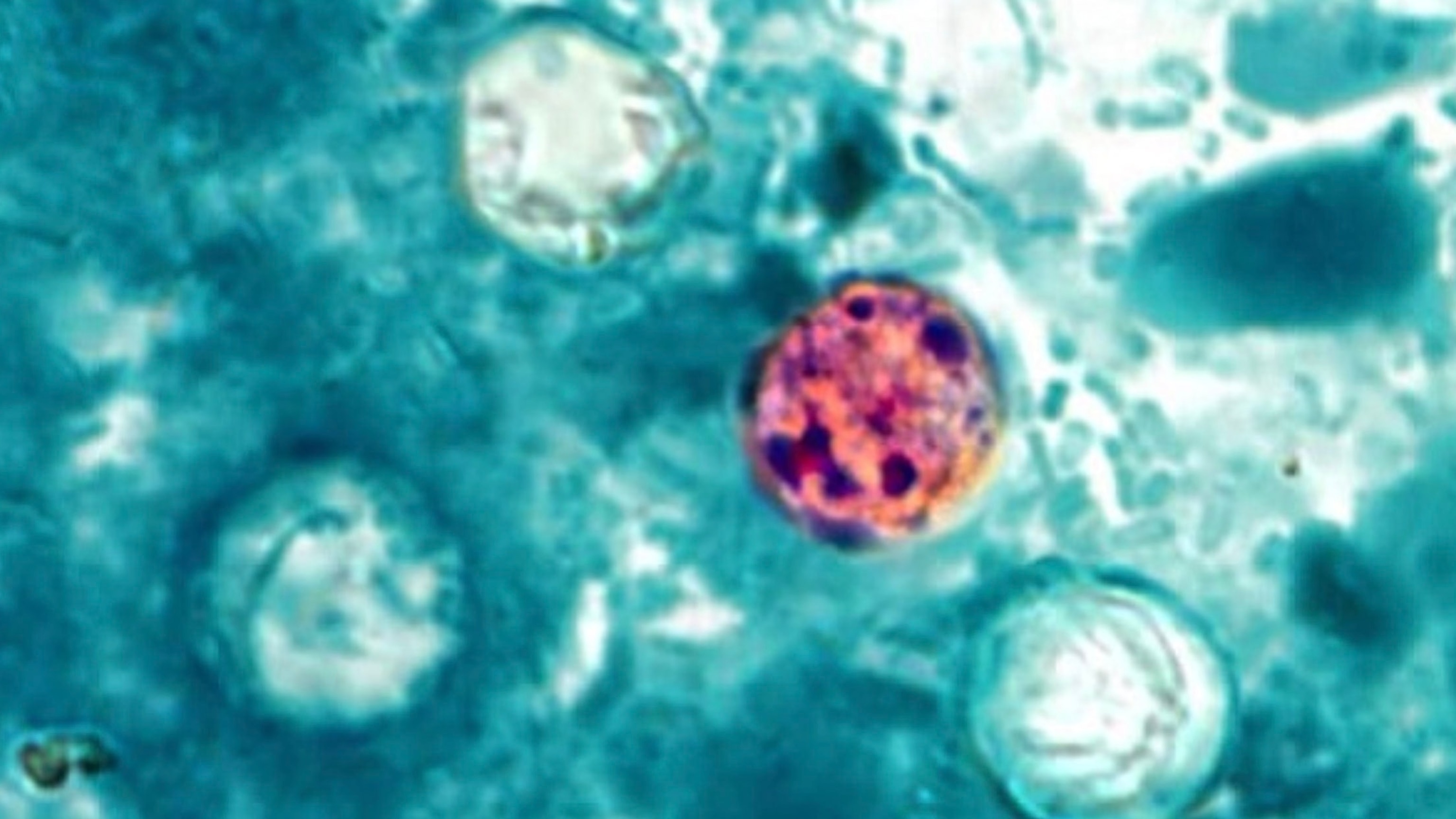 Cyclospora cayetanensis parasite under microscopy responsible for Michigan cyclosporiasis outbreak 2026