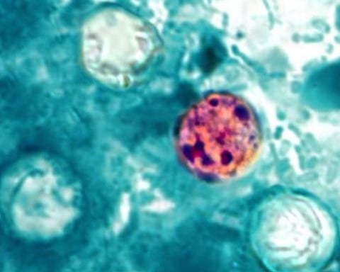 Cyclospora cayetanensis parasite under microscopy responsible for Michigan cyclosporiasis outbreak 2026
