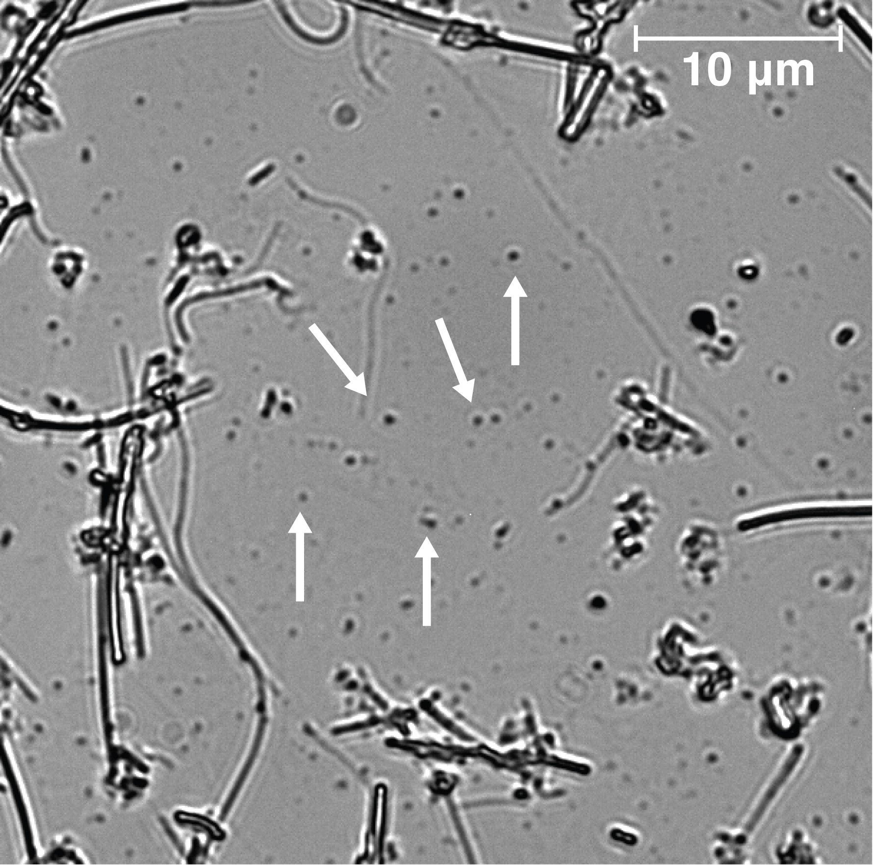 Nanoplastic particles viewed under a Raman spectrometer at UC Davis Environmental Toxicology lab