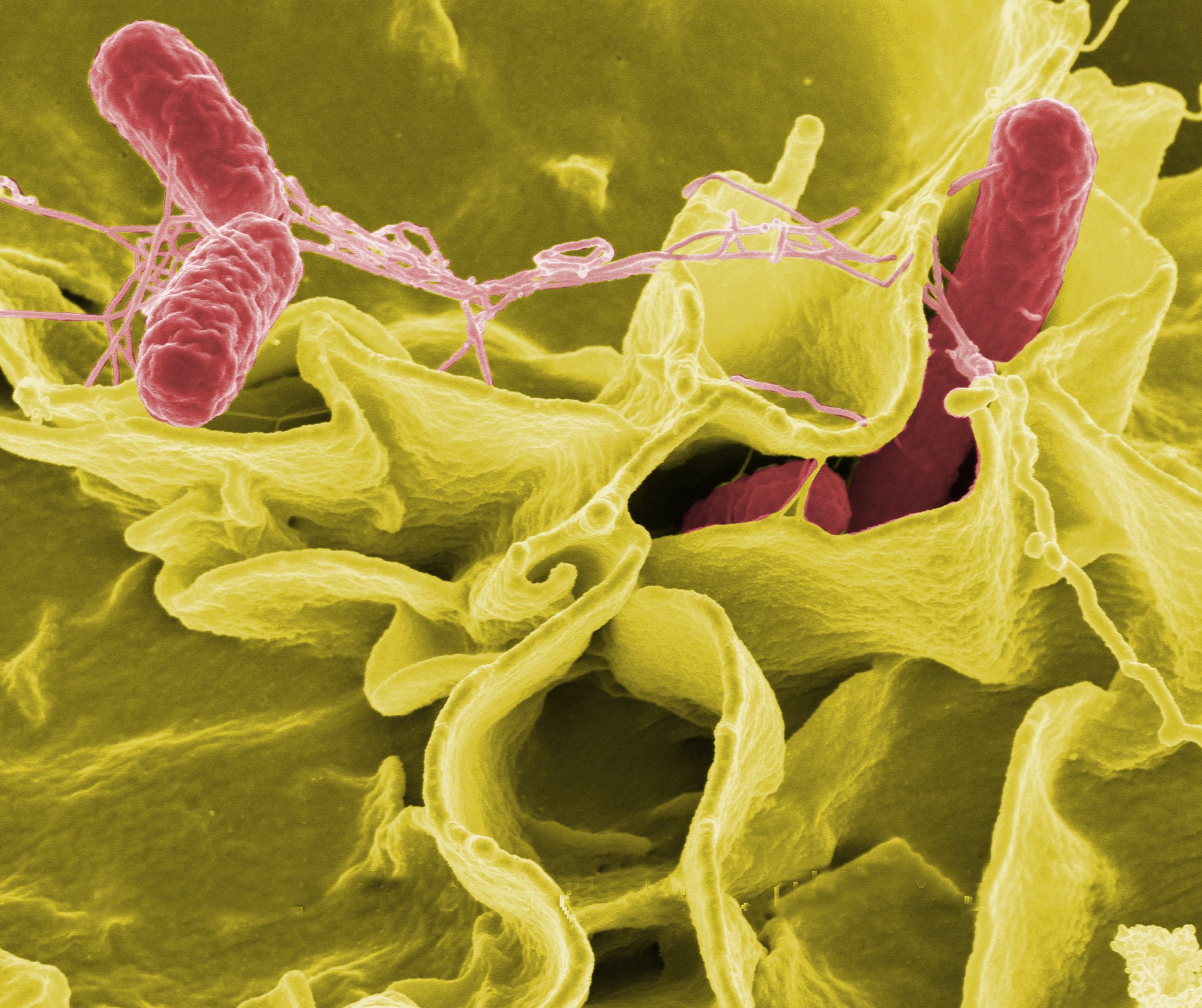 Salmonella bacteria colorized scanning electron microscope image NIAID NIH