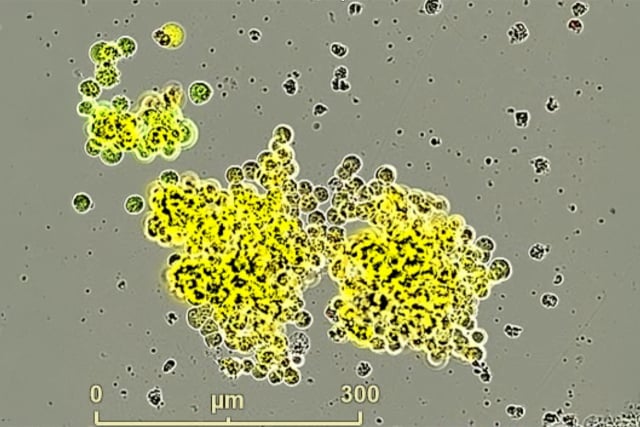 UCLA Witte Laboratory research into small cell neuroendocrine cancer molecular vulnerabilities