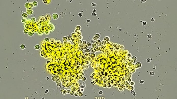 Microscopy image of small cell neuroendocrine prostate cancer model developed by the Witte Laboratory at UCLA