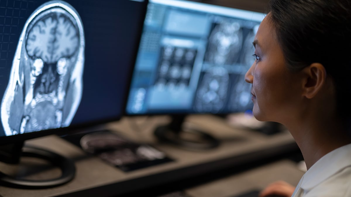 Health care professional reviewing brain scan images used in diagnosing and monitoring lacunar stroke