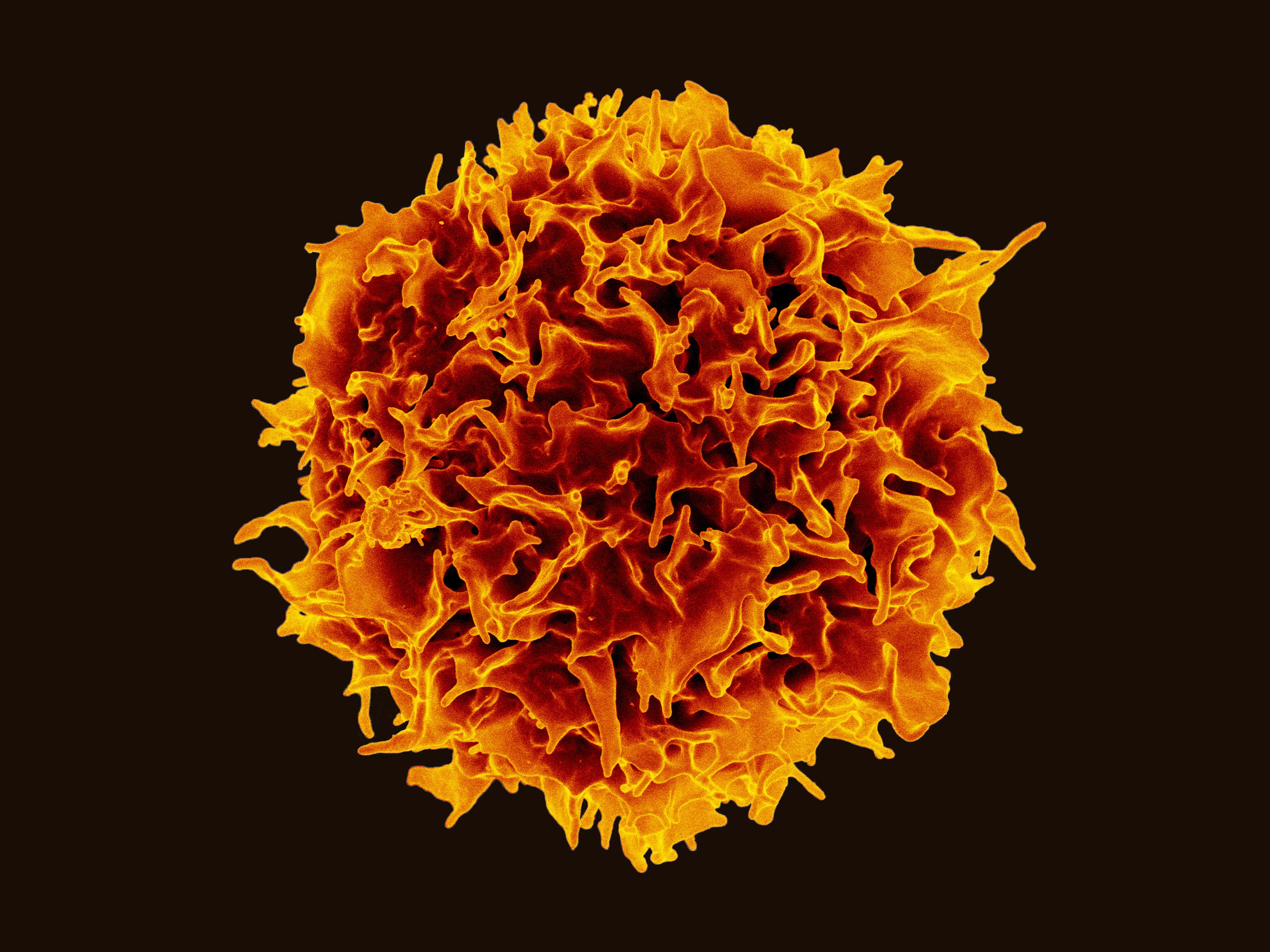 A colorized scanning electron micrograph of a T lymphocyte, the type of immune cell engineered in CAR-T therapy