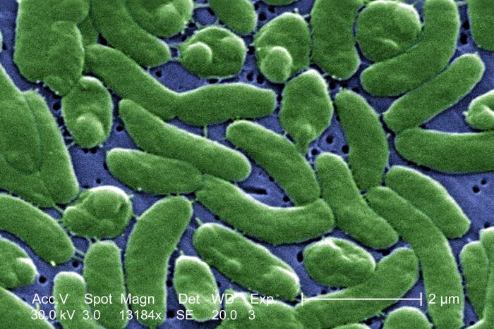 Digitally colorized scanning electron microscopic image of Vibrio vulnificus bacteria