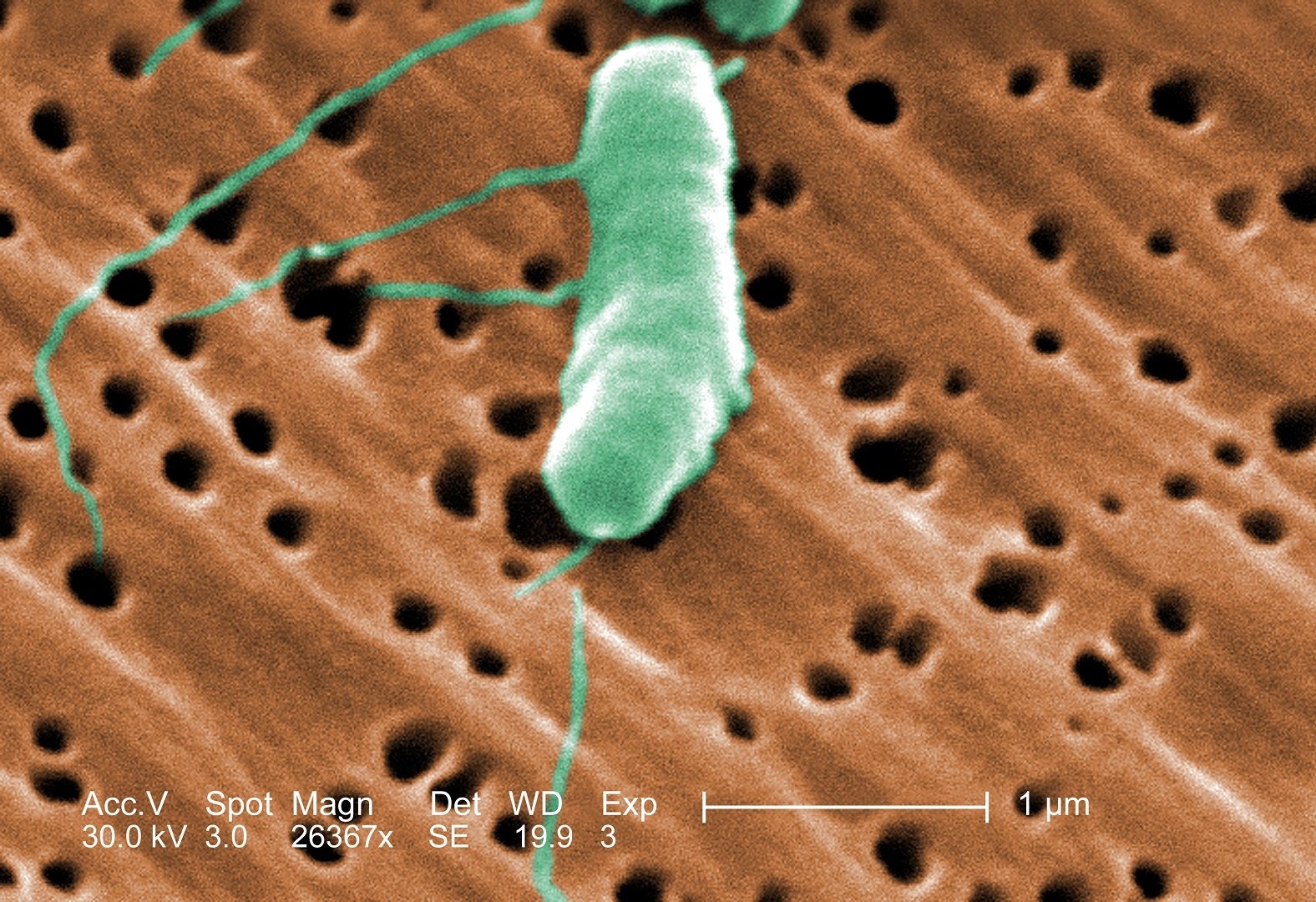 Colorized scanning electron micrograph of Vibrio vulnificus bacteria, the pathogen detected in Hamptons estuaries in 2026