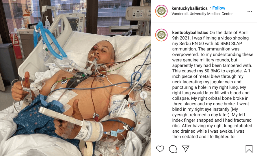 Kentucky Ballistics injury Instagram post