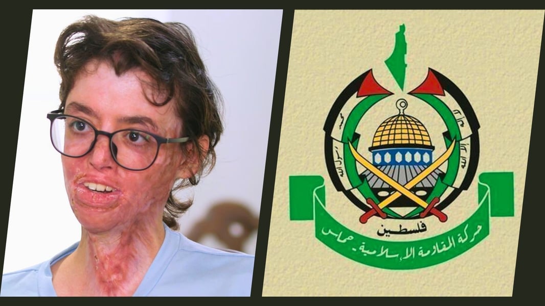 palestinian-girl-sarah-Burned-in-Israeli-Attack-on-Gaza-Palestine
