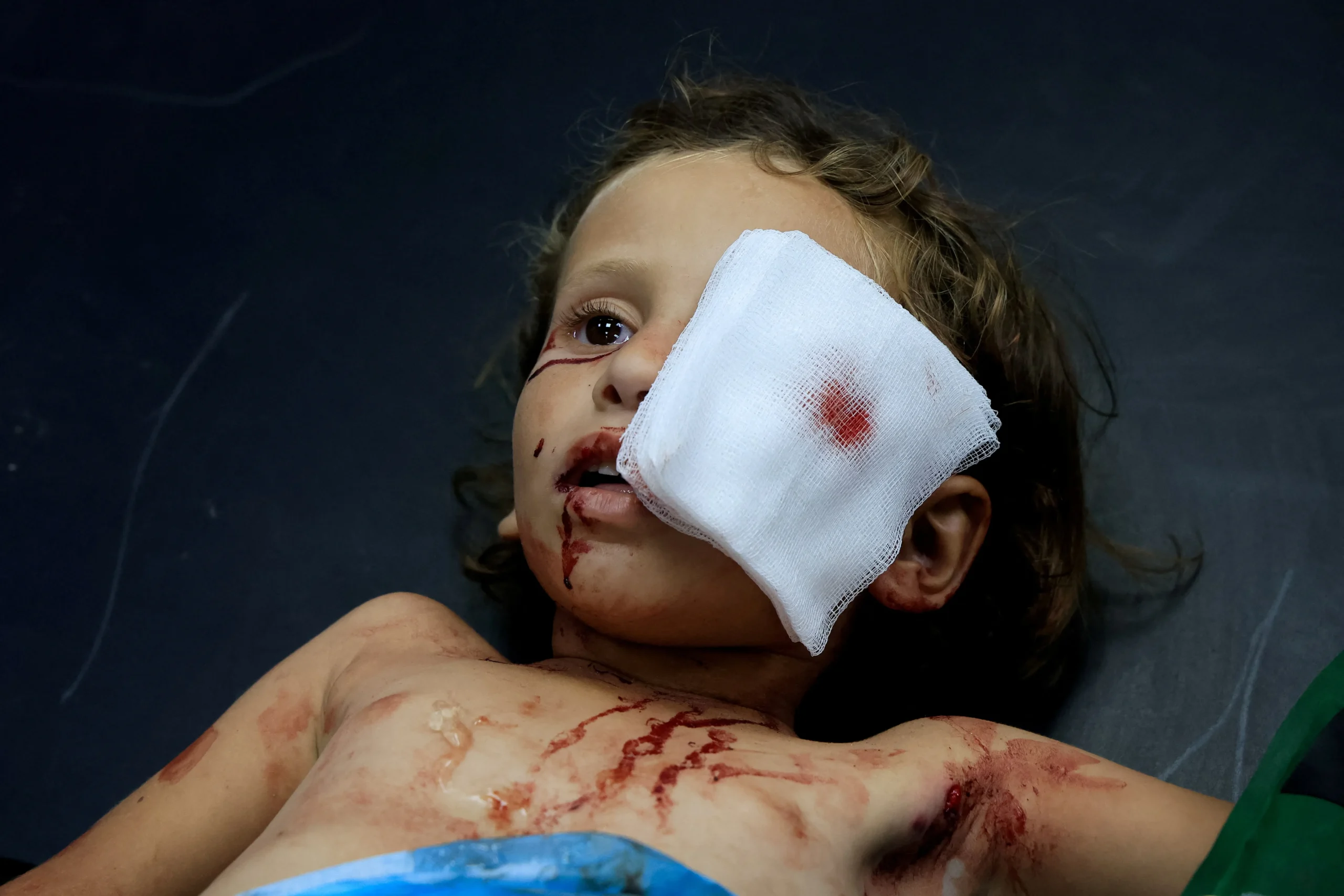 Gaza ceasefire, Hamas proposal, Israeli airstrikes, starvation crisis