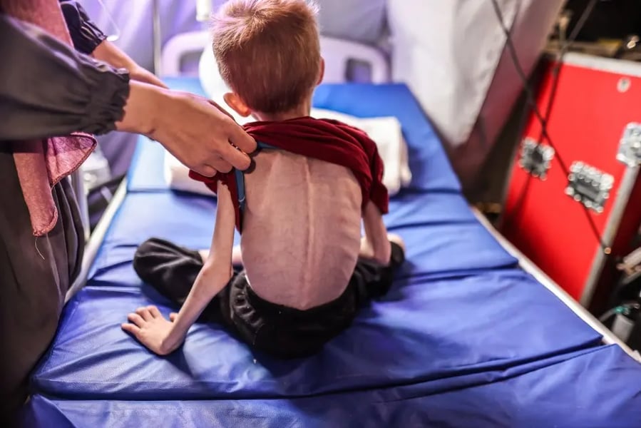 Palestinian child, Gaza famine, Gaza starvation, Israel blockade