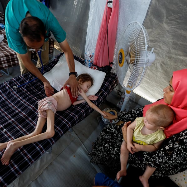 skeletal children arriving at wards skeletal children arriving at wards in gaza hospitals amid famine and collapsing health system