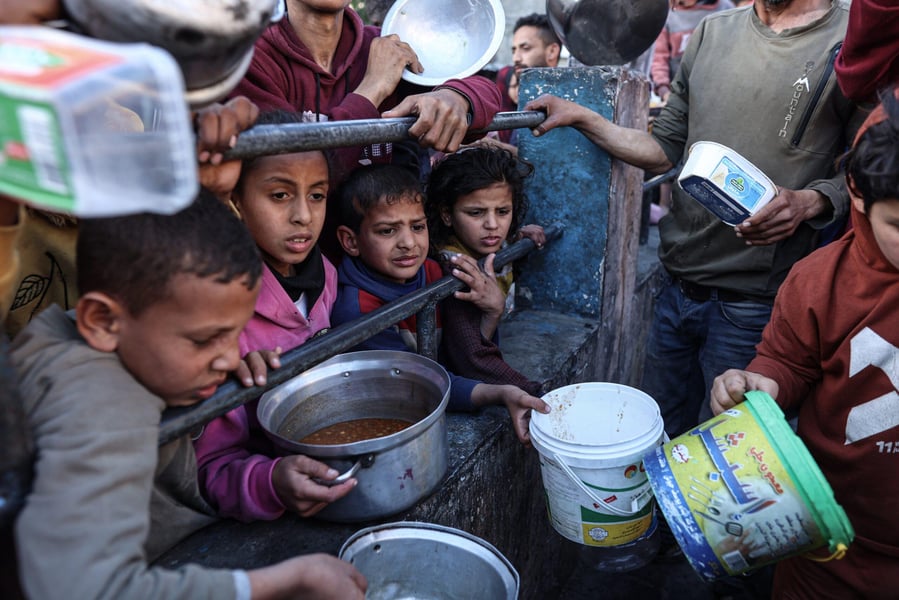 Children in Gaza suffering from severe malnutrition during famine
