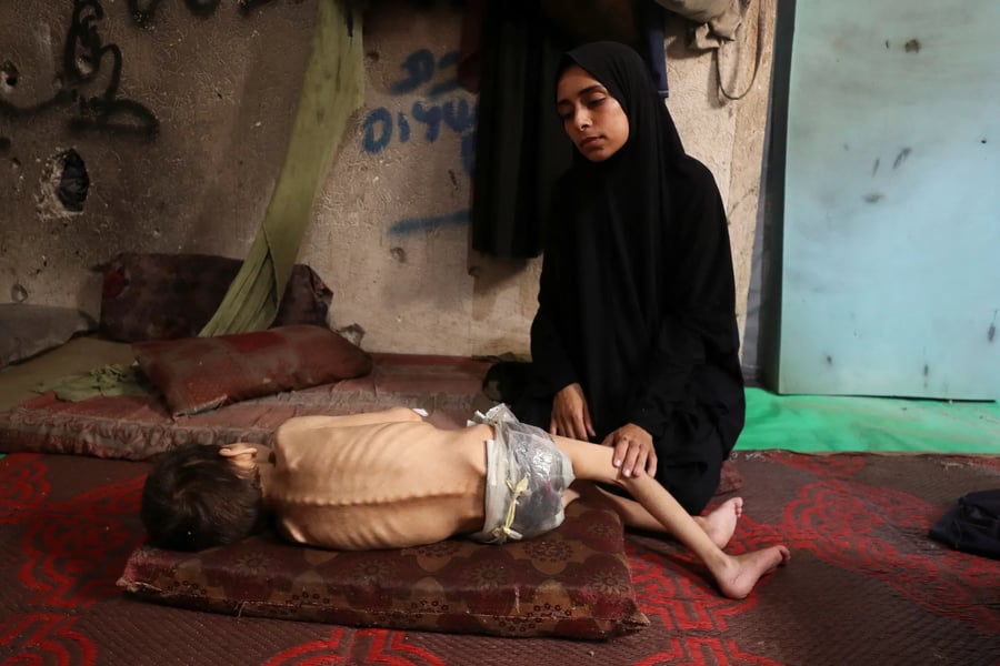 Displaced Palestinian mother holds her malnourished son inside a Gaza City school shelter, July 2025.