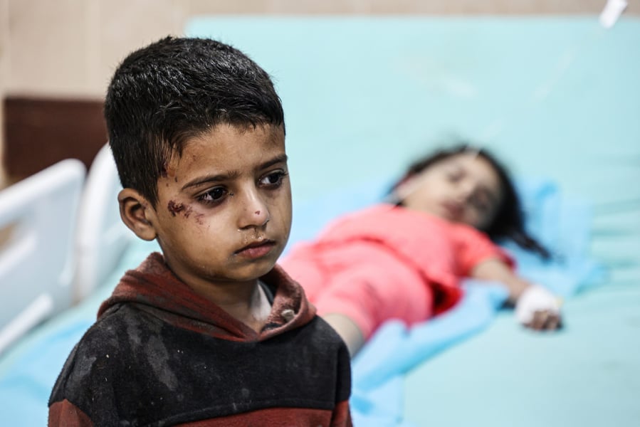 Palestinian children showing trauma amid Gaza conflict, 2025