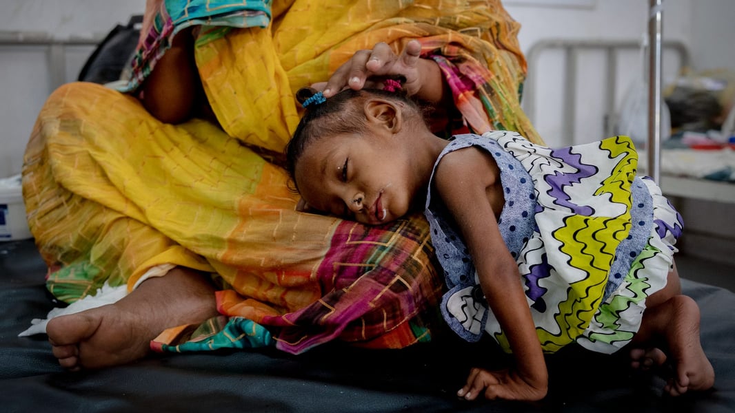 Sudan Famine: Children Face Catastrophic Malnutrition Rates Severely malnourished Sudanese children receiving emergency treatment during the civil war humanitarian crisis