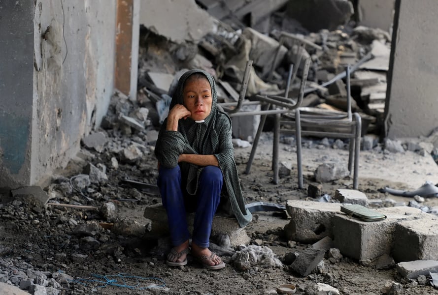 Palestinian children affected by Israeli attacks in Gaza