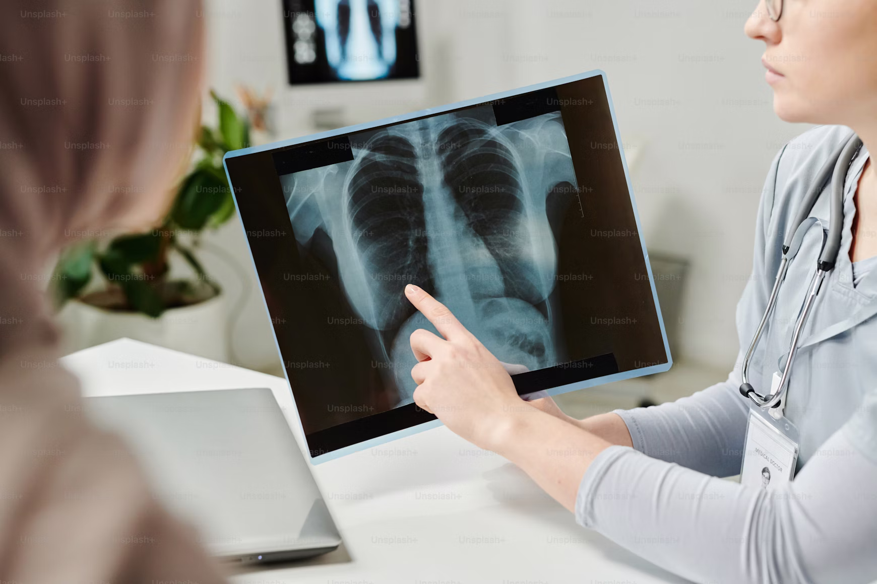 Young non-smoker lung cancer cases rising globally