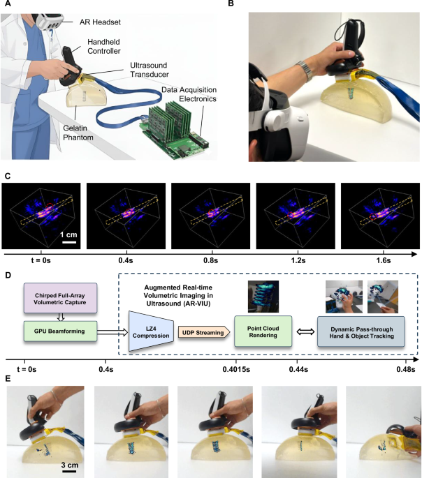 Diagram showing the AR-VIU augmented reality ultrasound system architecture and study design from the MIT Nature Communications Engineering paper