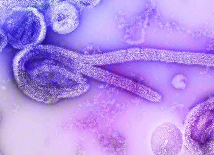 Colored scanning electron micrograph of Bundibugyo ebolavirus particles