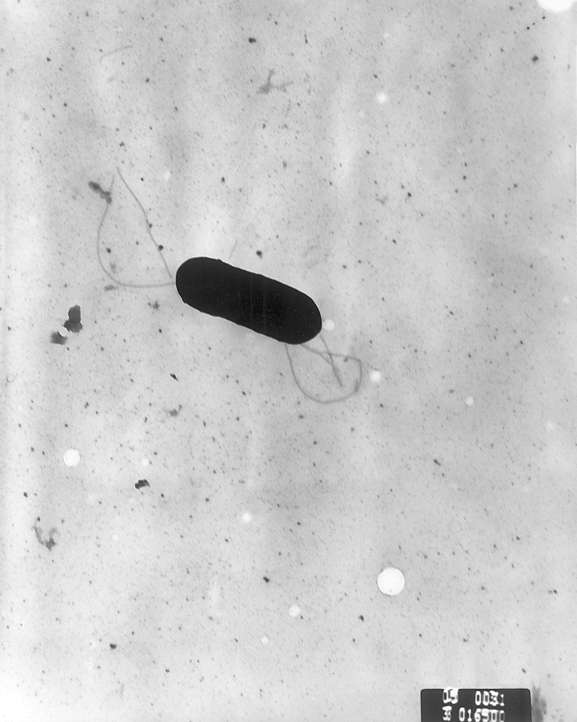 Electron microscope image of Listeria monocytogenes bacteria linked to the Clover Hill Dairy outbreak