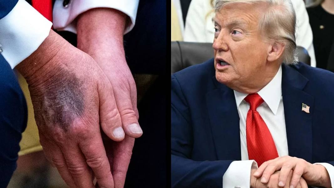 President Donald Trump departs Walter Reed National Military Medical Center in May 2026