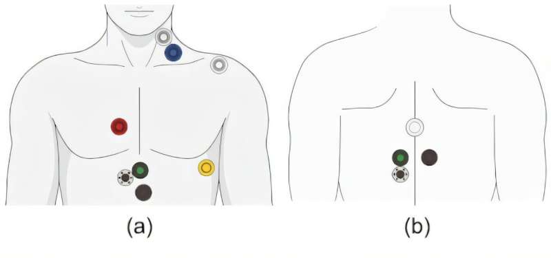 Non-invasive sensor devices used in Ateneo de Manila cardiac index AI study
