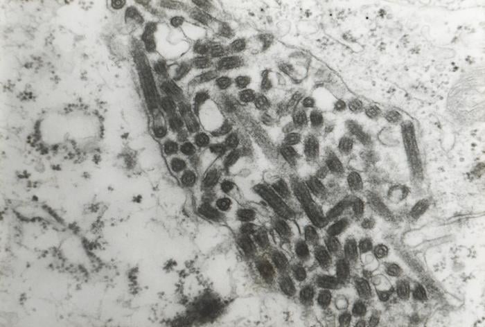 Transmission electron microscopic image confirming Marburg virus in a hemorrhagic fever patient