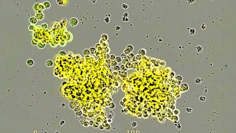 Microscopy image of small cell neuroendocrine prostate cancer model developed by the Witte Laboratory at UCLA