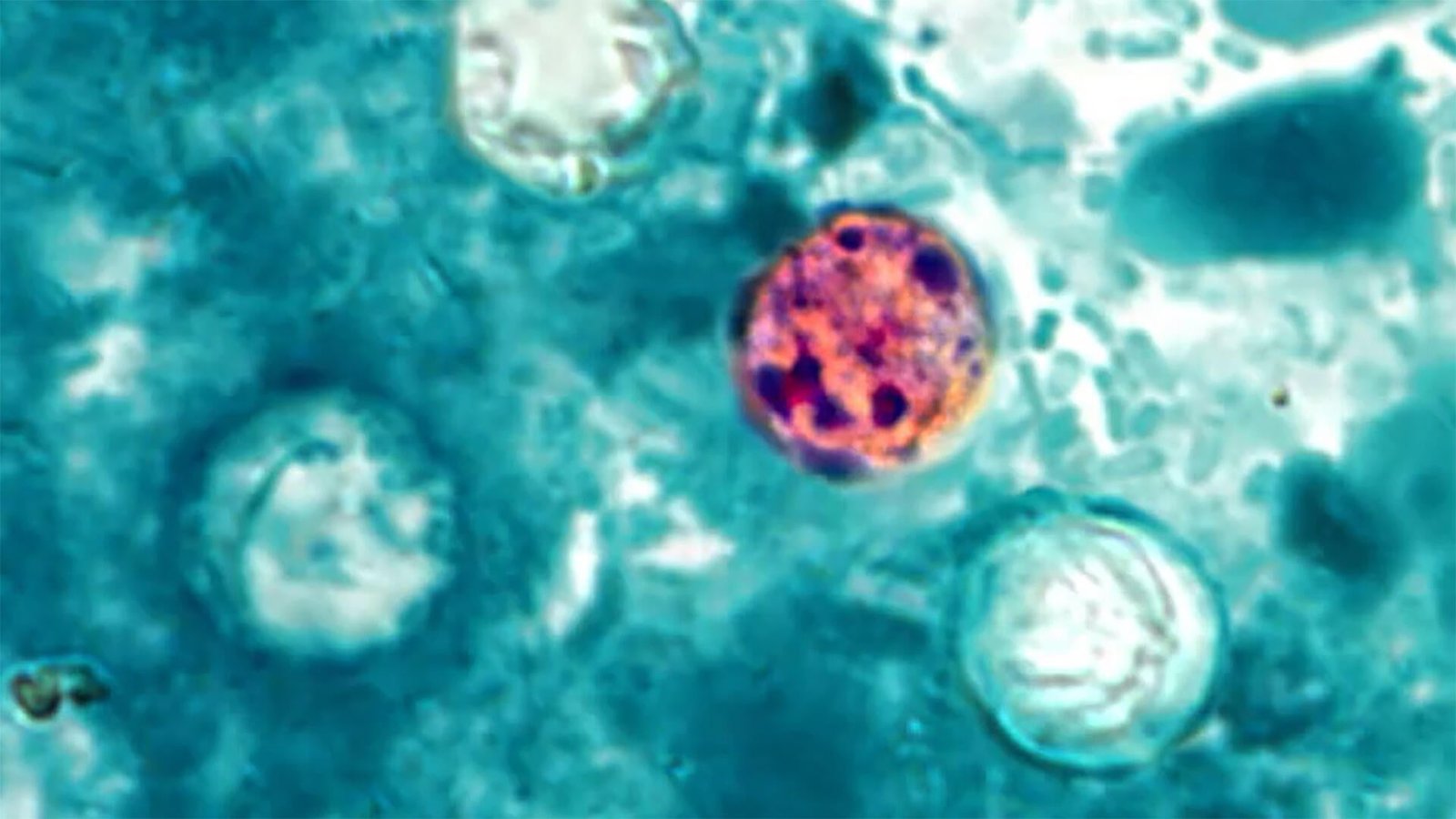 Medical illustration of Cyclospora cayetanensis parasite responsible for the 2026 Michigan outbreak that killed two residents