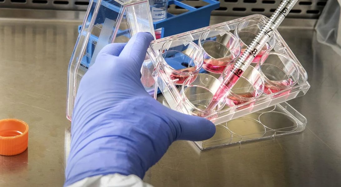 Amgen AMGN stock chart falls 9 percent on September 8 2026 after Novartis Lp(a) pelacarsen trial failure raises doubts about olpasiran pipeline