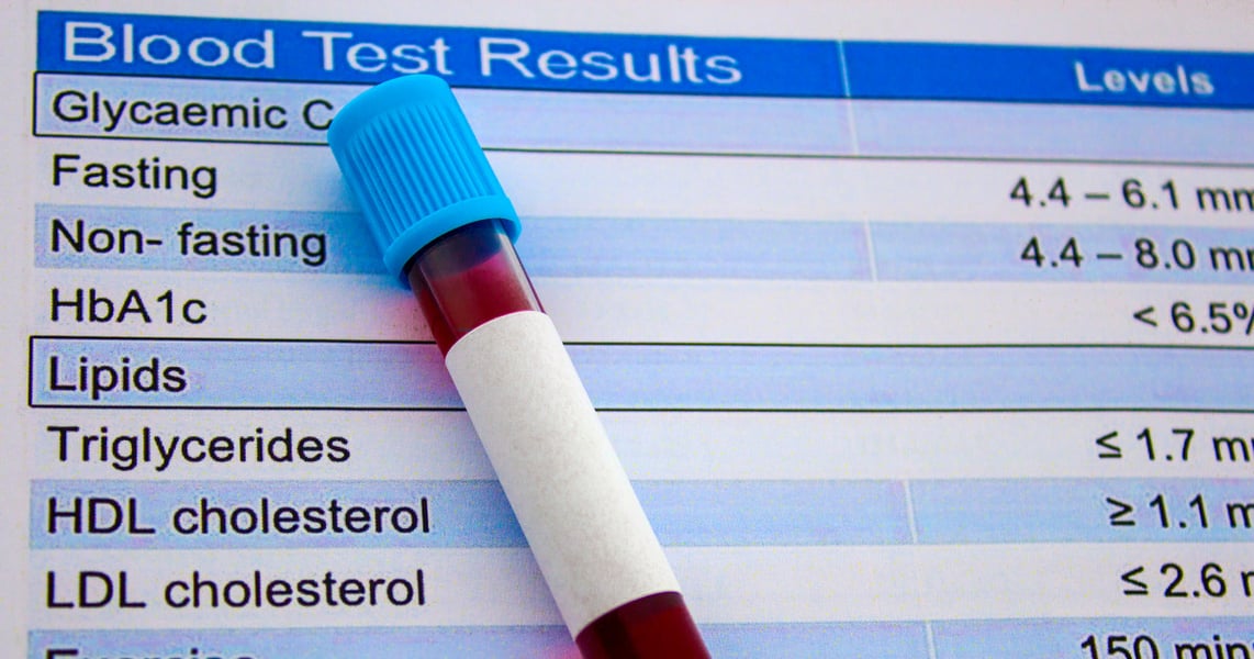 Blood vial used in cholesterol testing as CRISPR gene editing trial shows 53% LDL reduction