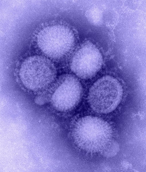 Colorized scanning electron micrograph of H1N1 influenza virus particles, the pathogen type mFlusiva is designed to protect against as the first mRNA flu vaccine approved by the FDA