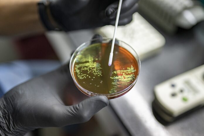 Scientist in a laboratory examining antimicrobial resistance samples, relevant to India's CDSCO warning on antibiotic overuse