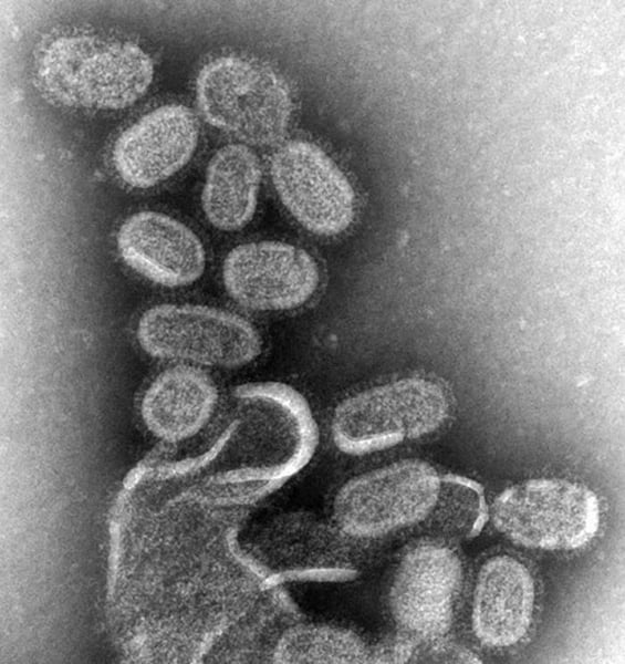 Electron microscope image of influenza virus particles, the pathogen targeted by mFlusiva the first mRNA flu vaccine approved by the FDA for adults 50 and older