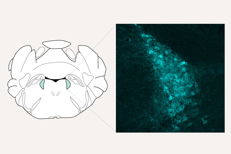 Researchers at Washington University School of Medicine identify mu opioid receptors in the locus coeruleus as a natural brake on chronic neuropathic pain