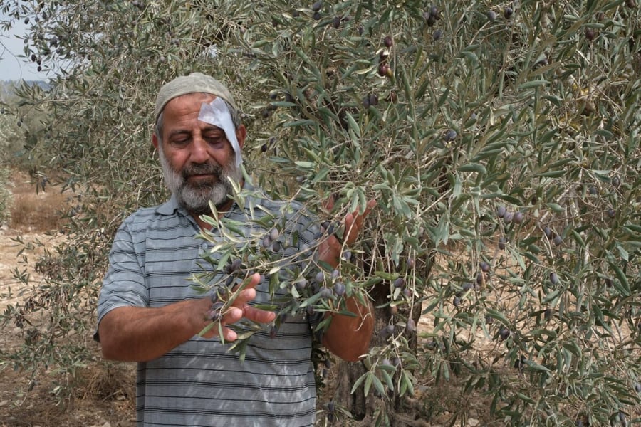Abdul Latif Al Bazzari, 59, with a bandage above his eye, touches olives on a branch in his family's grove near Nablus