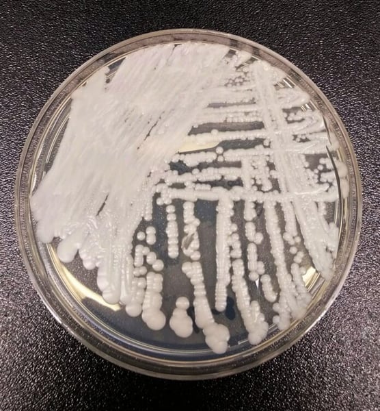 Petri dish culture plate with white colonies of the yeast Candida auris growing in streaks on agar