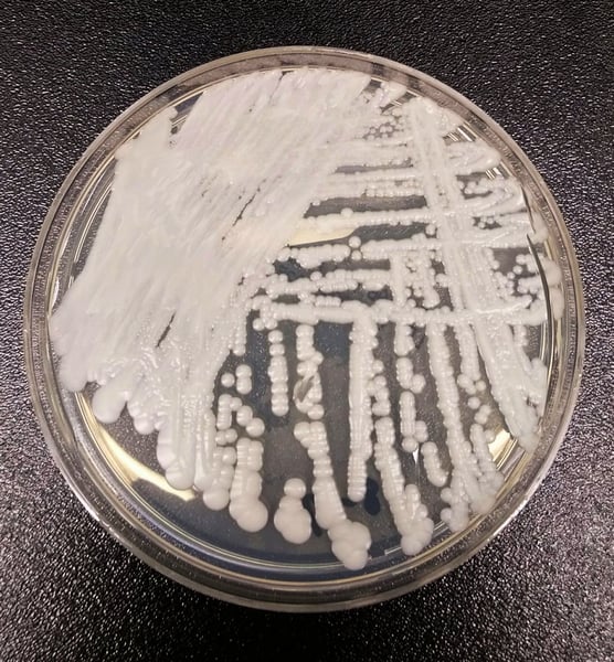 Petri dish culture plate with white colonies of the yeast Candida auris growing in streaks on agar