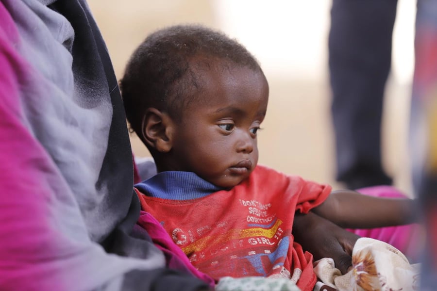 A child at a UNICEF-supported nutrition clinic in North Darfur, Sudan, in a file photograph