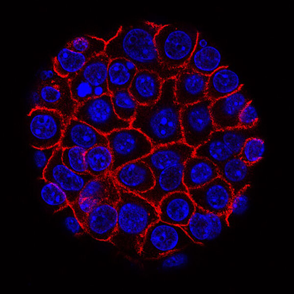 Pancreatic cancer cells growing in a sphere-shaped cluster, nuclei stained blue and cell membranes red