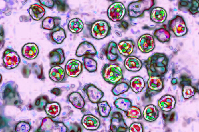 Colourised microscope image of measles virus particles