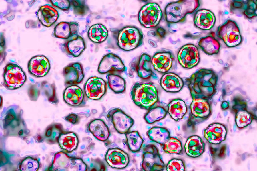 Colourised microscope image of measles virus particles